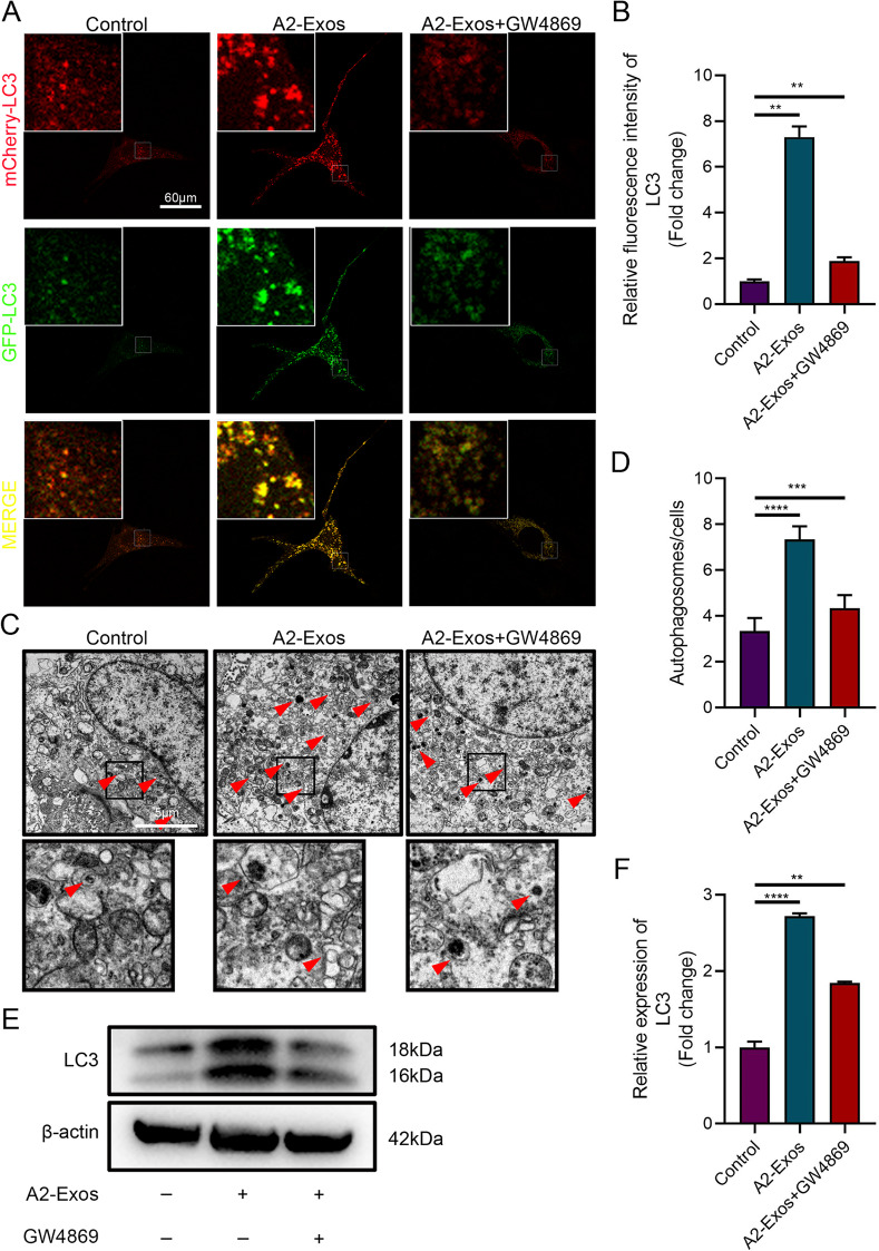 细胞自噬 细胞自噬