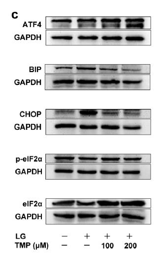 一文掌握内质网应激信号通路！