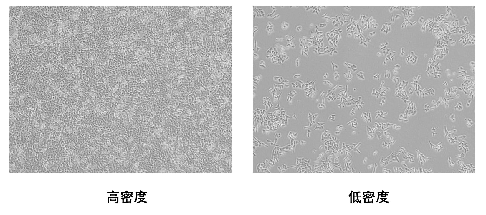 MH-22A：小鼠肝癌细胞的研究与应用