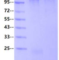 Pyrophosphatase, Inorganic(无机焦磷酸酶)