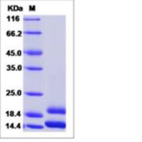 Recombinant Human MCP-1/CCL2 Protein (His Tag)