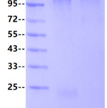 Human Tau-441/2N4R Protein, His tag-2
