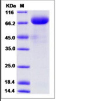 Recombinant Human VEGFR1/FLT1 Protein (hFc Tag), HPLC-verified