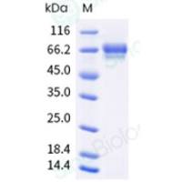 Recombinant Human Vitronectin Protein (His Tag)