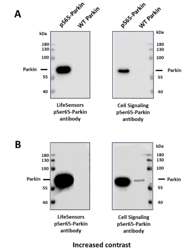 磷酸帕金（pS65）兔多克隆抗体特惠，助力实验加速