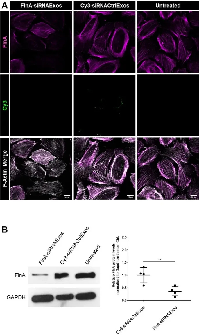 Western blot检测 Western blot检测