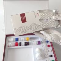 Trionyx Sinensis Spherovirus(TSSV)中华鳖球状病毒染料法荧光定量PCR试剂盒