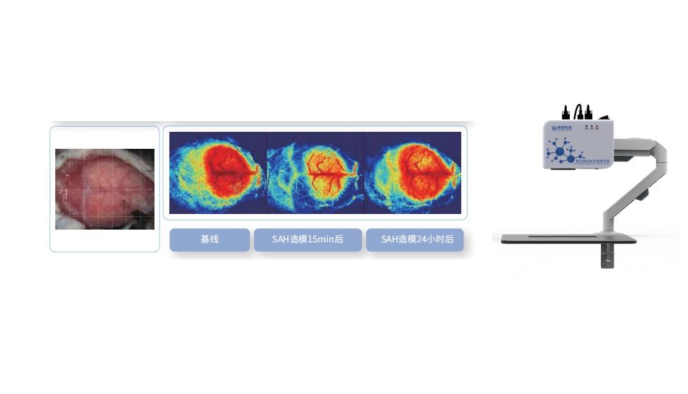 【新品发布】激光散斑血流成像系统