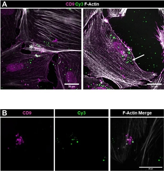 细胞摄取 细胞摄取