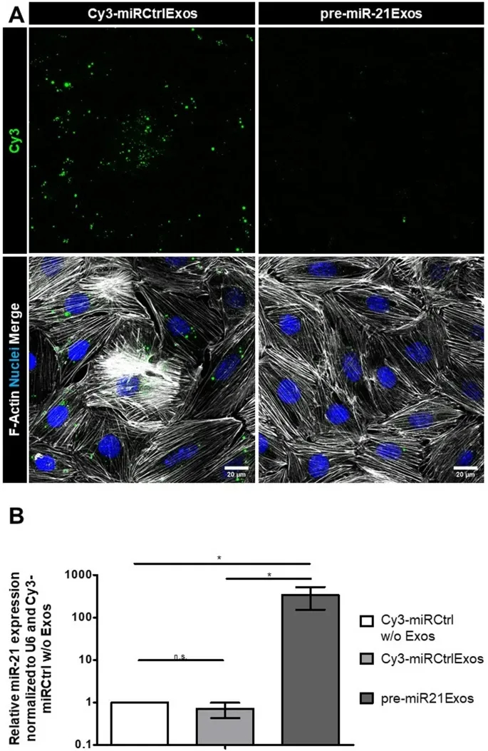 RT-PCR检测 RT-PCR检测