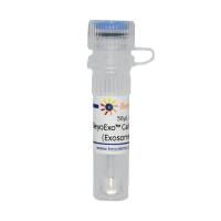BeyoExo™ Calnexin Rabbit mAb (Exosome Validated)