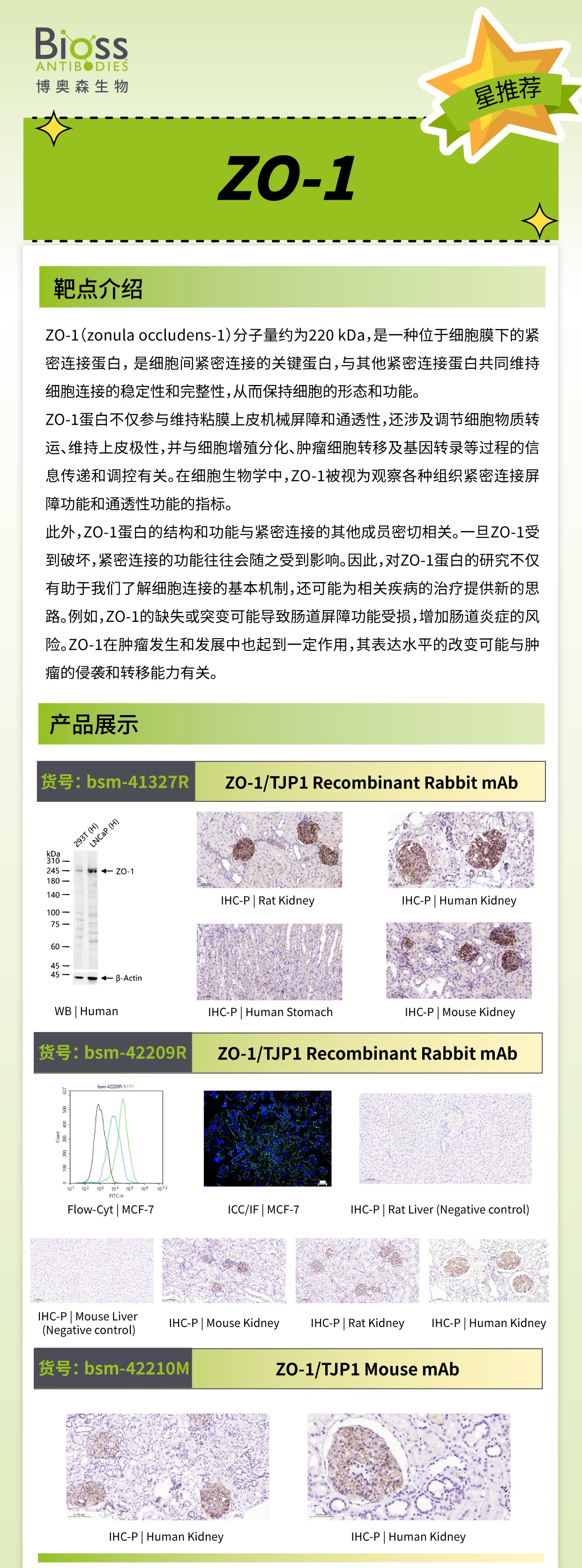 Bioss 星推荐 | ZO-1 抗体