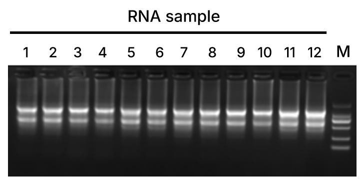 上新 | 翌圣酵母表达DNase l，告别RNA提取中的DNA污染困扰