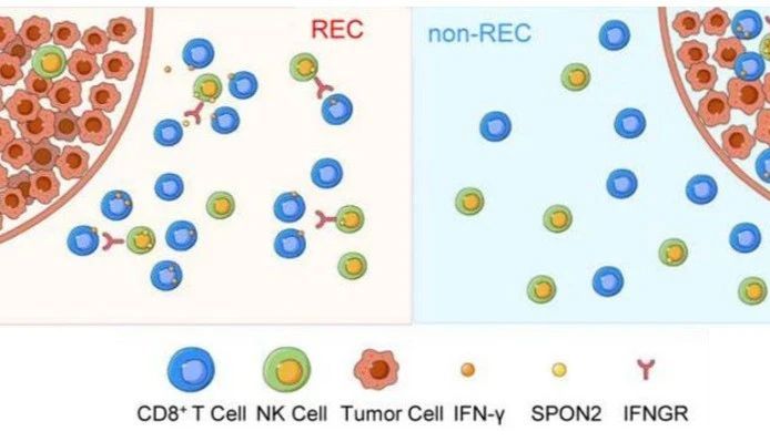《Nature》IF：50.5！首创：结合空间特征来预测肝癌复发（中科大团队）