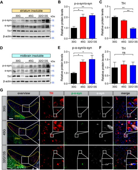 Mol Neu丨CGGC中度重复会诱导类似早期帕金森病的表型