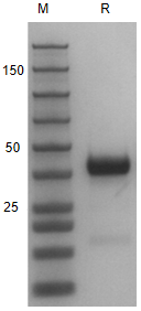 Recombinant Human PRLR/His Pro
