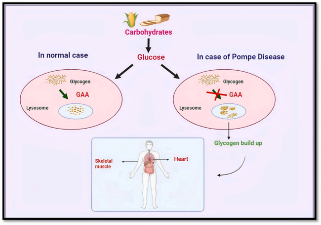 肌肉“甜蜜”的负担:Gaa KO小鼠助力攻克庞贝病难题