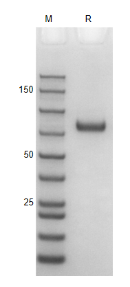 Recombinant Human IL-12rB1/ Hi