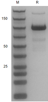 Recombinant Human PSMA/His Pro