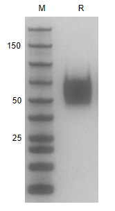 Recombinant Human IL-7R/ His P