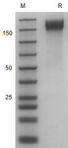 Recombinant Human SEZ6L/ His P