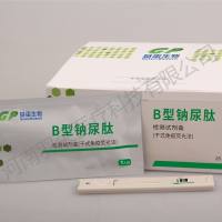 基蛋生物 B型钠尿肽检测试剂盒(干式免疫荧光法))