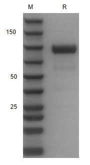 Recombinant Human AXL/hFC Prot