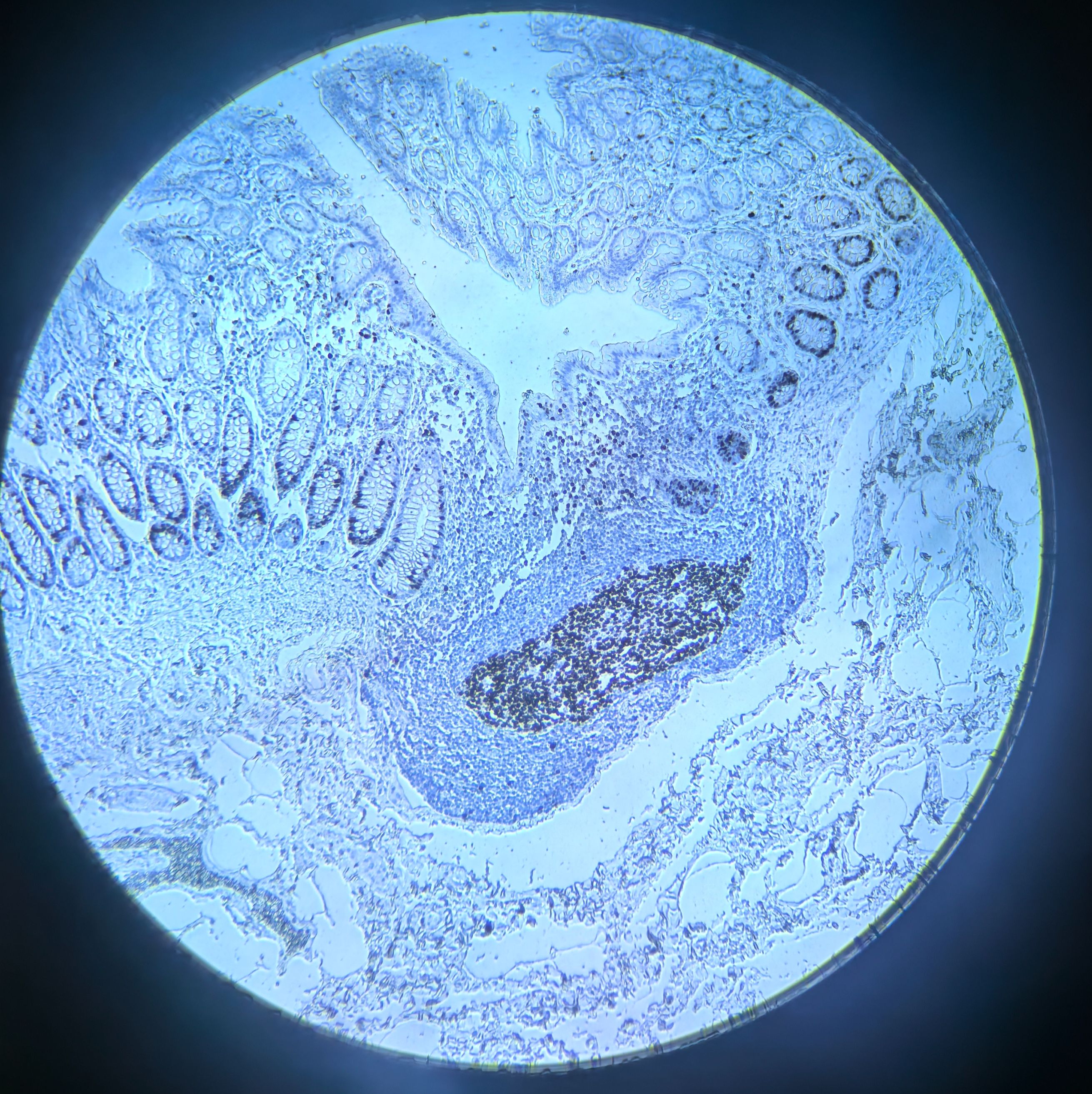 多聚HRP抗鼠/兔IgG增强型（聚合物）
