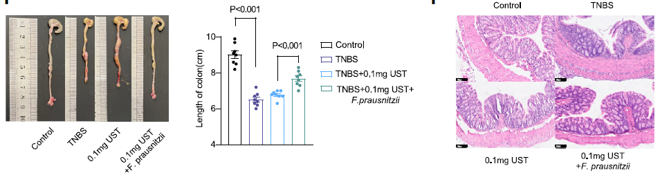 【文献解读】肠道微生物 L-鸟氨酸在增强乌司替尼单抗治疗克罗恩病疗效中的协同作用