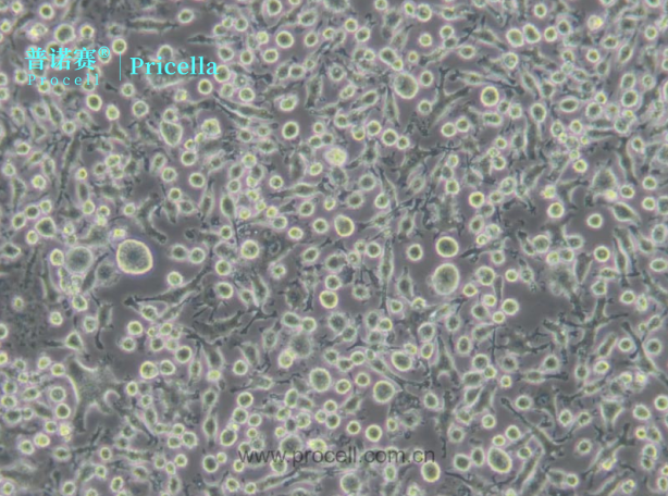 BV2 小鼠小胶质细胞特性及应用价值详细情况了解