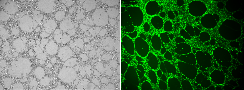 基质胶应用(2)—HUVEC血管形成实验