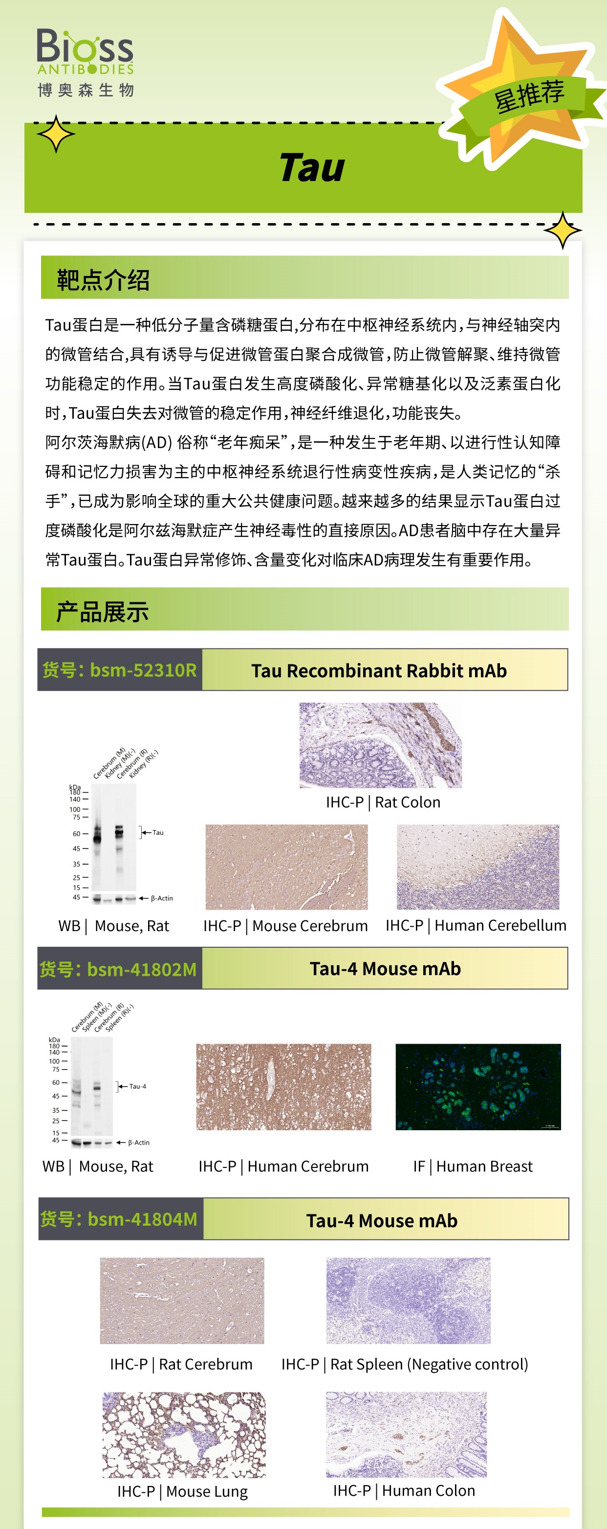 Bioss 星推荐 | Tau 抗体