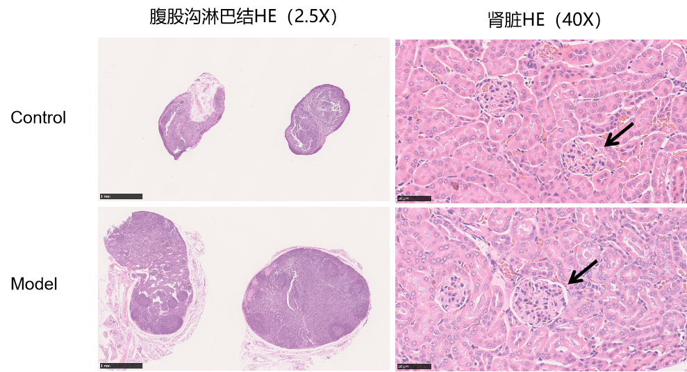 SLE动物模型助推疾病机制解析与治疗创新