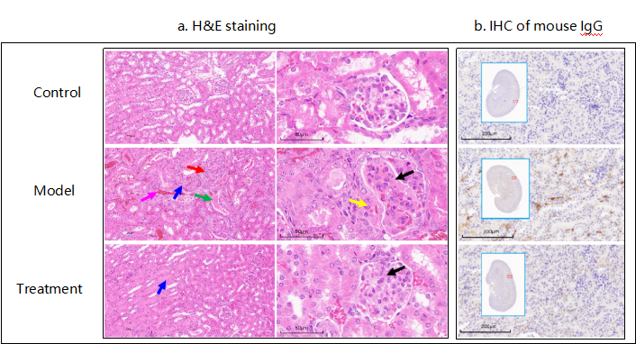 SLE动物模型助推疾病机制解析与治疗创新