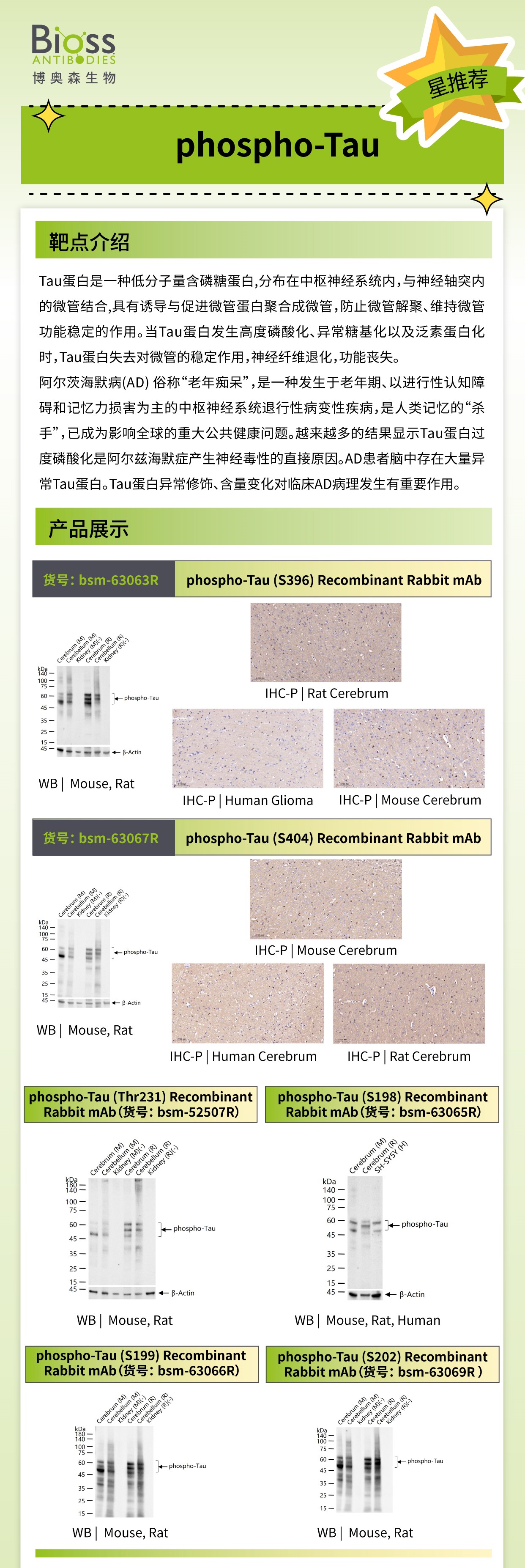 Bioss 星推荐 | phospho-Tau 抗体