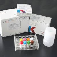 KGEHC120-1 人脂联素(Adiponection) KGEHC120