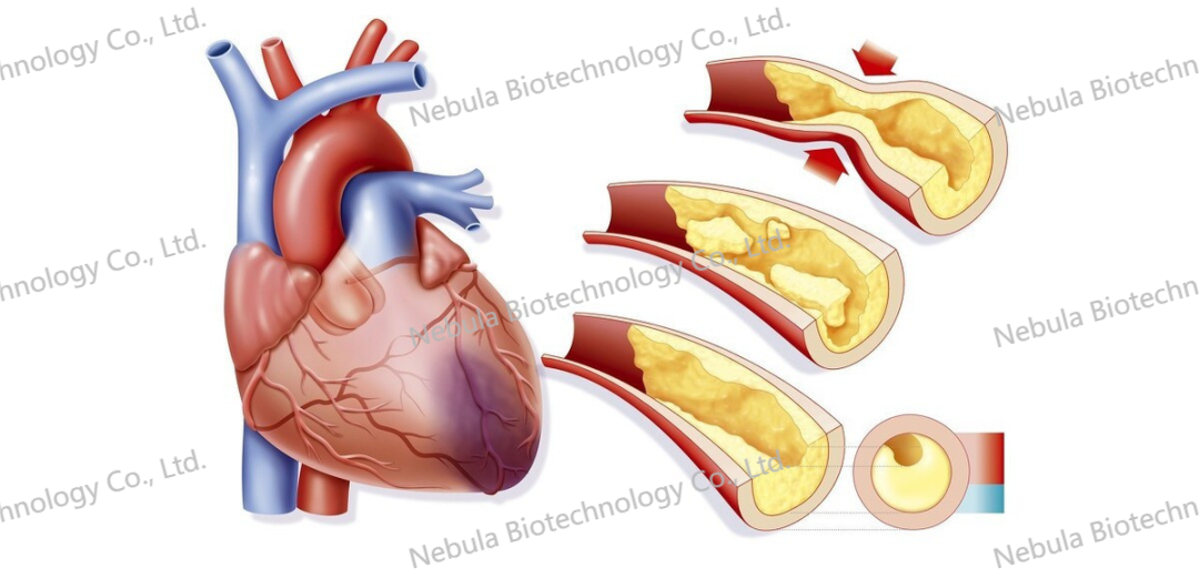 ELISA讲堂2：心血管相关靶点介绍