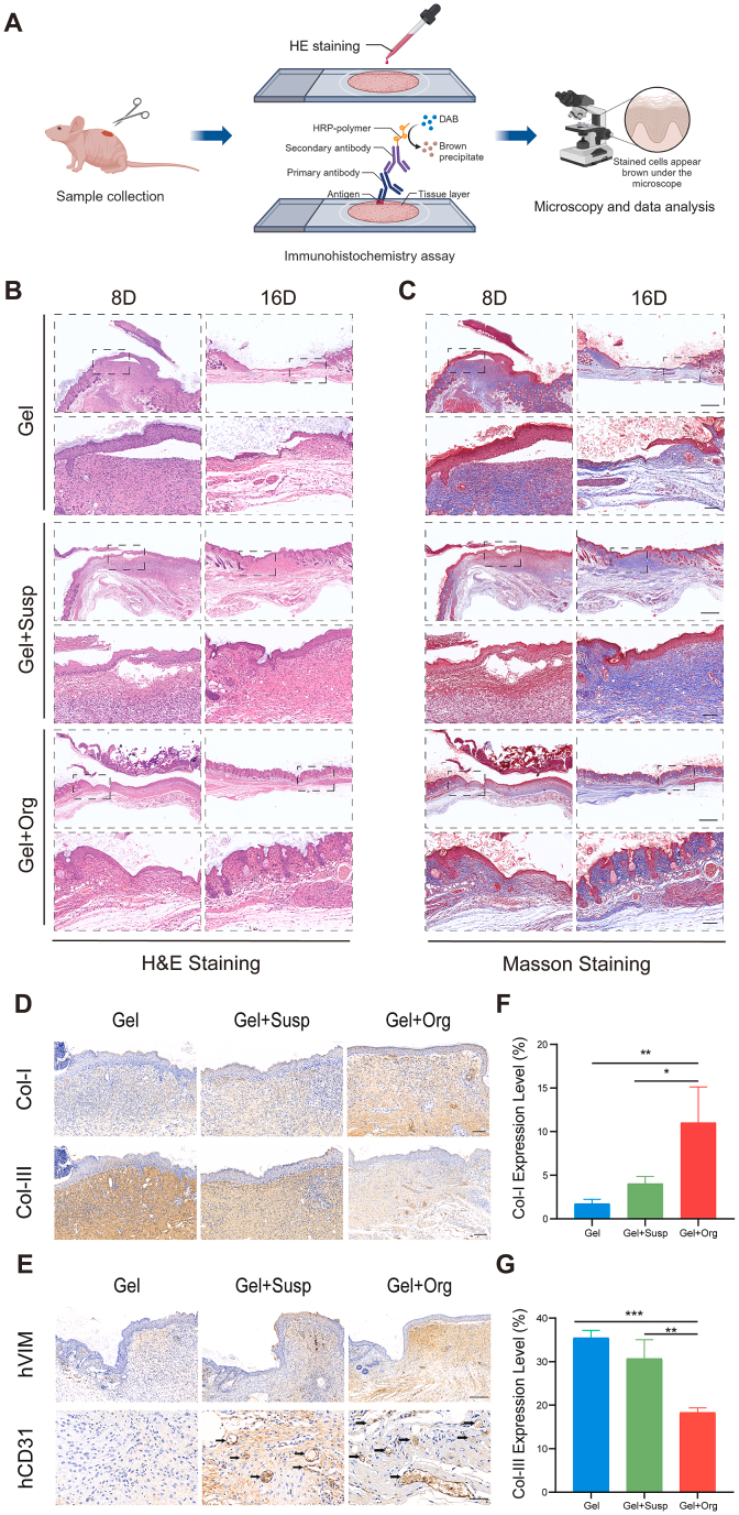 图5.生物3D打印皮肤类器官通过原位替换修复伤口并改善伤口愈合质量。
