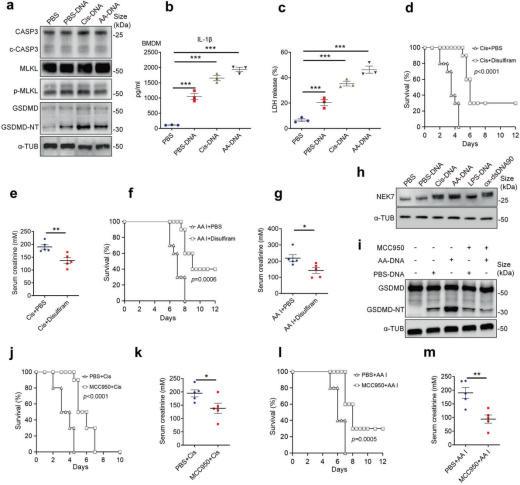 STTT（IF=40.8）丨氧化自身 DNA 与急性肾损伤：A20 如何精准调控炎症反应？