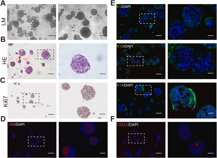 图1. 自组装球状皮肤类器官的制备与表征。