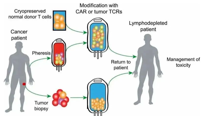 细胞疗法：开启医学领域的再生革命