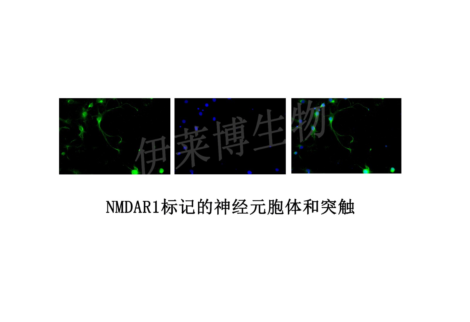 NMDAR1标记的神经元胞体和突触.jpg
