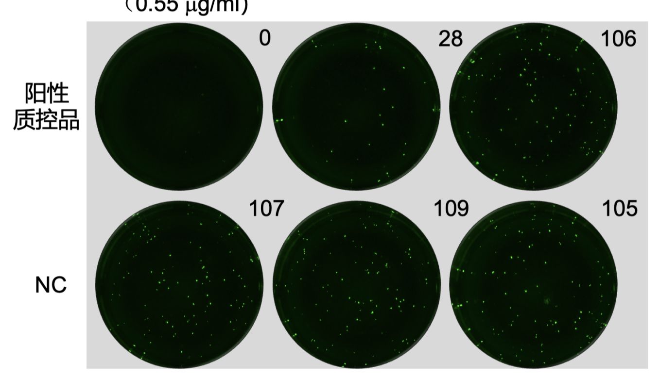 「DIFF+」抗偏肺病毒｜俄罗斯多地爆发“不明原因重症肺炎”病例