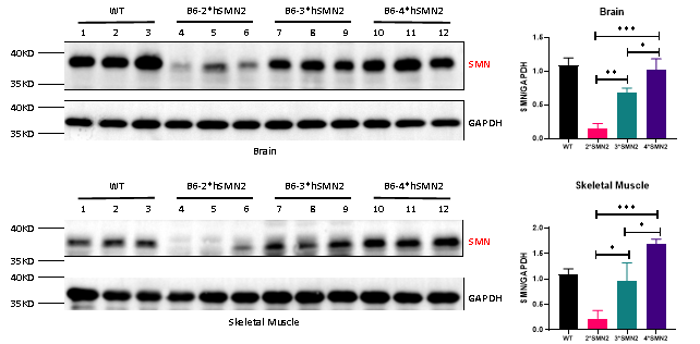 脊髓性肌萎缩症（SMA）全谱系模型：携带不同SMN2拷贝数的人源化小鼠