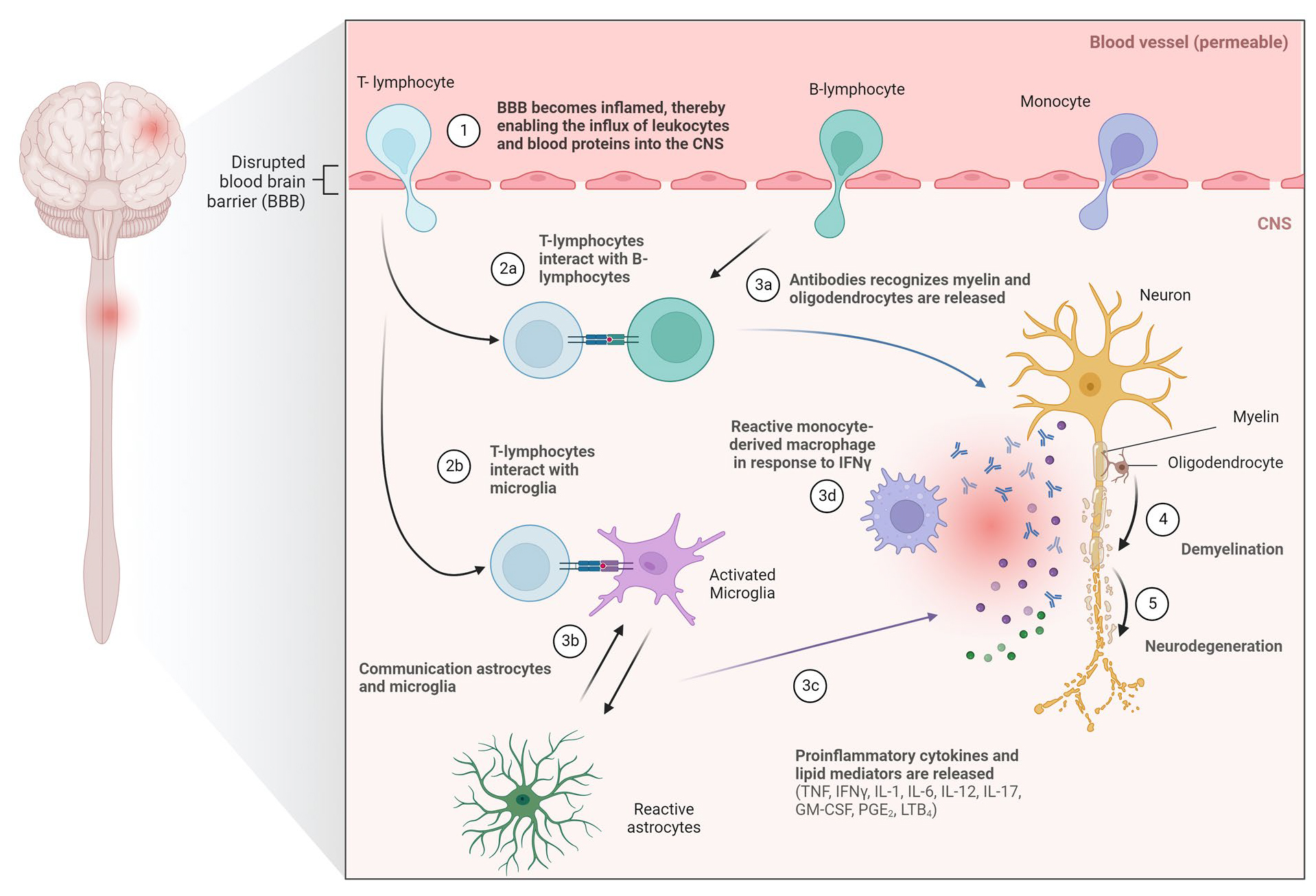 多发性硬化症这类自免疾病在B细胞耗竭领域的研究进展如何呢？