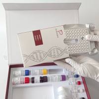 Allpaahuayo virus(ALLV)奥尔帕瓦约病毒染料法荧光定量RT-PCR试剂盒