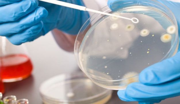 【菌落】CFU计量方式与直接计数分析