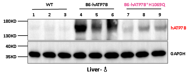 B6-hATP7B*H1069Q小鼠：铜代谢、威尔逊病及基因编辑疗法研究的精准人源化模型
