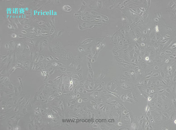 稳定传代HK-2人肾皮质近曲小管上皮细胞：肾脏疾病机制探索利器