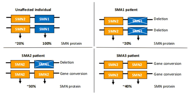 脊髓性肌萎缩症（SMA）全谱系模型：携带不同SMN2拷贝数的人源化小鼠